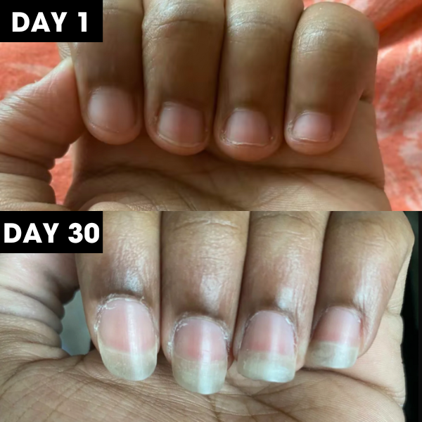 Nail Nourish™ Cuticle & Nail Oil Pen