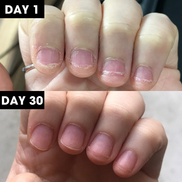 Nail Nourish™ Cuticle & Nail Oil Pen